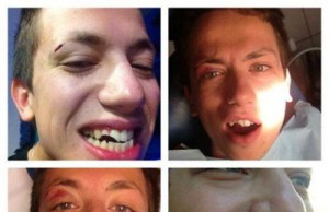 Дурнев остался в Днепродзержинске без зубов