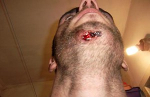 Активист-ремонтник обвиняет милиционера и охранника в избиении