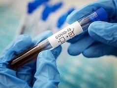 В Каменском откроют лабораторию для тестирования на COVID-19